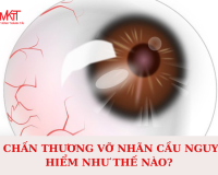 CHẤN THƯƠNG VỠ NHÃN CẦU NGUY HIỂM NHƯ THẾ NÀO?